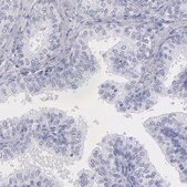 Anti-MB antibody produced in rabbit Prestige Antibodies&#174; Powered by Atlas Antibodies, affinity isolated antibody, buffered aqueous glycerol solution