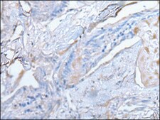 Anti-TUBB affinity isolated antibody