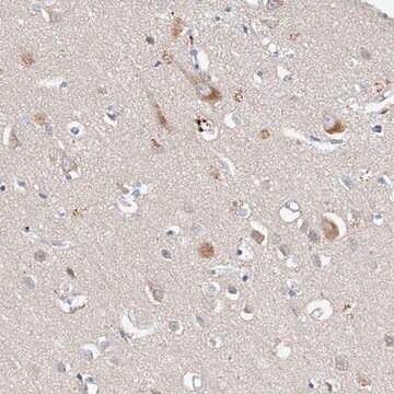 Anti-CARMIL3 antibody produced in rabbit Prestige Antibodies&#174; Powered by Atlas Antibodies, affinity isolated antibody, buffered aqueous glycerol solution