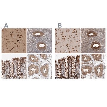 Anti-EIF3I antibody produced in rabbit Prestige Antibodies&#174; Powered by Atlas Antibodies, affinity isolated antibody, buffered aqueous glycerol solution