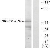 Anti-SAPK antibody produced in rabbit affinity isolated antibody