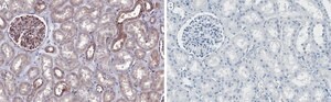 Anti-ROCK-1 Antibody, clone 3K23 ZooMAb&#174; Rabbit Monoclonal recombinant, expressed in HEK 293 cells
