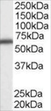 Anti-DDX5/P68 RNA helicase antibody produced in goat affinity isolated antibody, buffered aqueous solution