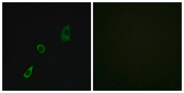 Anti-FGF23 antibody produced in rabbit affinity isolated antibody