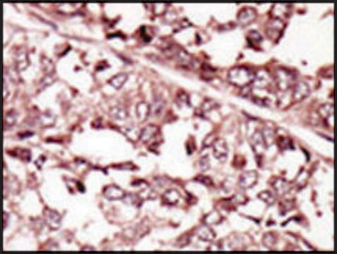 Anti-ROS (N-term) antibody produced in rabbit IgG fraction of antiserum, buffered aqueous solution