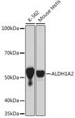 Anti-ALDH1A2 antibody produced in rabbit