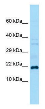 Anti-Grem1 (C-terminal) antibody produced in rabbit affinity isolated antibody