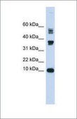 Anti-FABP3 (ab2) antibody produced in rabbit affinity isolated antibody