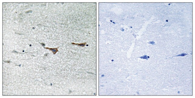 Anti-TOB1 antibody produced in rabbit affinity isolated antibody