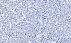 Anti-Catalase Antibody, clone 1C21 ZooMAb&#174; Rabbit Monoclonal recombinant, expressed in HEK 293 cells