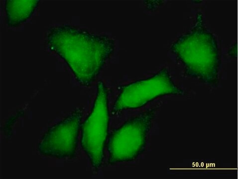 Anti-PRKAR1B antibody produced in mouse purified immunoglobulin, buffered aqueous solution