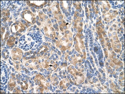 Anti-CDH3 antibody produced in rabbit IgG fraction of antiserum