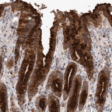 Anti-MLPH antibody produced in rabbit Prestige Antibodies&#174; Powered by Atlas Antibodies, affinity isolated antibody, buffered aqueous glycerol solution