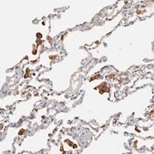Anti-TFRC antibody produced in rabbit Prestige Antibodies&#174; Powered by Atlas Antibodies, affinity isolated antibody, buffered aqueous glycerol solution