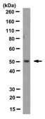Anti-CYP51A1 Antibody, clone N6-P2H5*G8 clone N6-P2H5*G8, from mouse