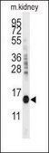 Anti-CDA (C-term) antibody produced in rabbit saturated ammonium sulfate (SAS) precipitated, buffered aqueous solution
