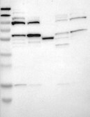 Anti-DRD1 antibody produced in rabbit Prestige Antibodies&#174; Powered by Atlas Antibodies, affinity isolated antibody, buffered aqueous glycerol solution