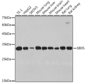 Anti-SBDS Antibody, clone 9V4J9, Rabbit Monoclonal