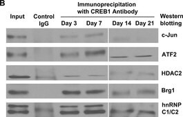 Anti-HDAC2 Antibody, clone 3F3 clone 3F3, Upstate&#174;, from mouse