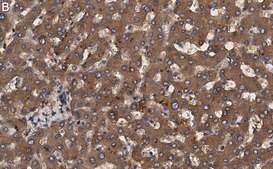 Anti-Transferrin Antibody, clone 2B8 , ZooMAb&#174; Rabbit Monoclonal recombinant, expressed in HEK 293 cells