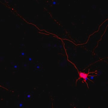 Neuro-Chrom Pan Neuronal Marker Antibody-Rabbit, Cy3 Conjugate Neuro-Chrom, from rabbit