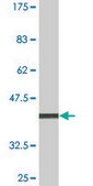 Monoclonal Anti-LCK, (N-terminal) antibody produced in mouse clone 3H5, purified immunoglobulin, buffered aqueous solution