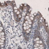 Monoclonal Anti-LAMA3 antibody produced in mouse Prestige Antibodies&#174; Powered by Atlas Antibodies, clone CL3112, purified immunoglobulin, buffered aqueous glycerol solution