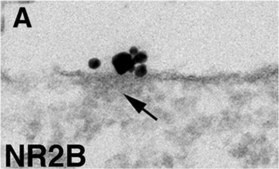 Anti-NMDAR2A&amp;B Antibody, pan Chemicon&#174;, from rabbit