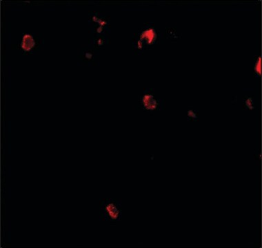 Anti-Cbl antibody produced in rabbit affinity isolated antibody, buffered aqueous solution