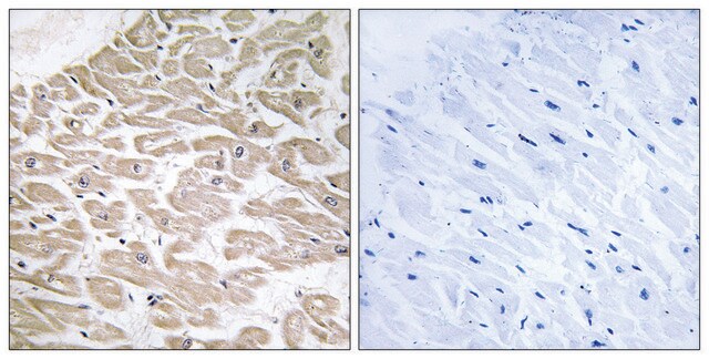 Anti-RAD antibody produced in rabbit affinity isolated antibody