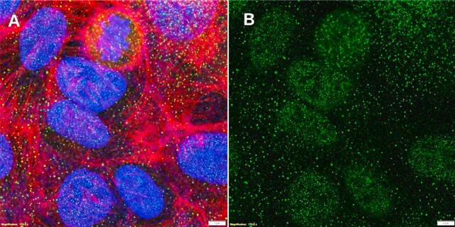 Anti-CDX2 Antibody, clone 1N7 ZooMAb&#174; Rabbit Monoclonal recombinant, expressed in HEK 293 cells