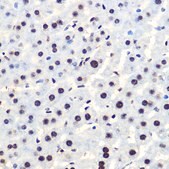 Anti-Phospho-I&#954;B&#945;-S36 antibody produced in rabbit