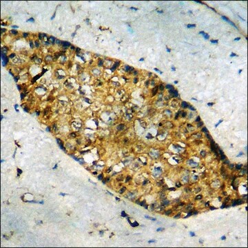 Anti-phospho-Smad3 (pSer213) antibody produced in rabbit affinity isolated antibody