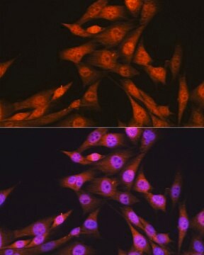 Anti- Smad1 antibody produced in rabbit