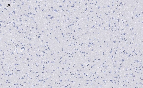 Anti-VGluT1 Antibody, clone 4O15, ZooMAb&#174; Rabbit Monoclonal recombinant, expressed in HEK 293 cells