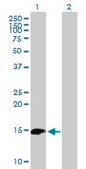 Anti-BIRC5 antibody produced in mouse purified immunoglobulin, buffered aqueous solution