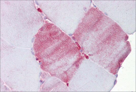 Anti-FABP3 antibody produced in rabbit affinity isolated antibody