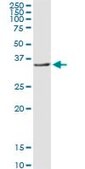 Anti-TNNT1 antibody produced in rabbit purified immunoglobulin, buffered aqueous solution