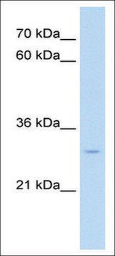 Anti-NR5A2 (AB2) antibody produced in rabbit affinity isolated antibody