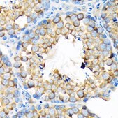 Anti-ALDH1A2 antibody produced in rabbit
