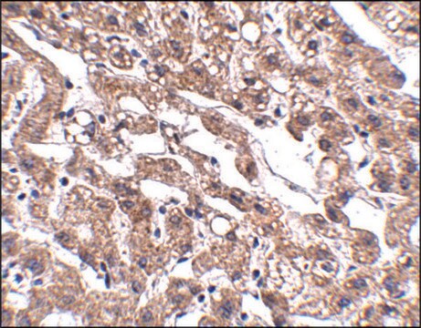 Anti-MACC1 antibody produced in rabbit affinity isolated antibody, buffered aqueous solution