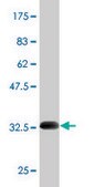Monoclonal Anti-SCN9A antibody produced in mouse clone 5A11, purified immunoglobulin, buffered aqueous solution