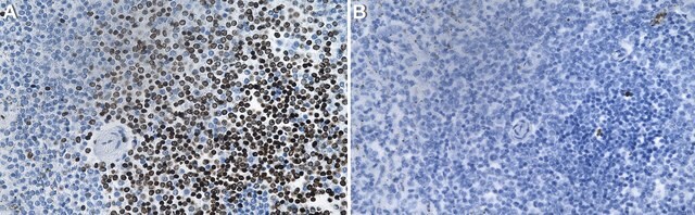 Anti-FAN1 Antibody, clone 2B15 ZooMAb&#174; Rabbit Monoclonal recombinant, expressed in HEK 293 cells