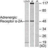 Anti-Adrenergic Receptor &#945;-2A antibody produced in rabbit affinity isolated antibody