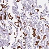 Anti-PLBD1 antibody produced in rabbit Prestige Antibodies&#174; Powered by Atlas Antibodies, affinity isolated antibody, buffered aqueous glycerol solution