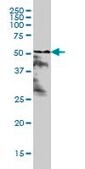 ANTI-RARA antibody produced in mouse clone 1C10, purified immunoglobulin, buffered aqueous solution