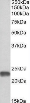 Anti-SOD2 antibody produced in goat affinity isolated antibody, buffered aqueous solution