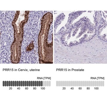 Anti-PRR15 antibody produced in rabbit Prestige Antibodies&#174; Powered by Atlas Antibodies, affinity isolated antibody, buffered aqueous glycerol solution