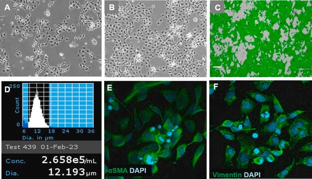 LX-2 Hepatic Stellate Cell Line-SF Adapted