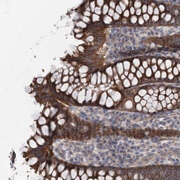 Anti-MARK2 antibody produced in rabbit Prestige Antibodies&#174; Powered by Atlas Antibodies, affinity isolated antibody, buffered aqueous glycerol solution